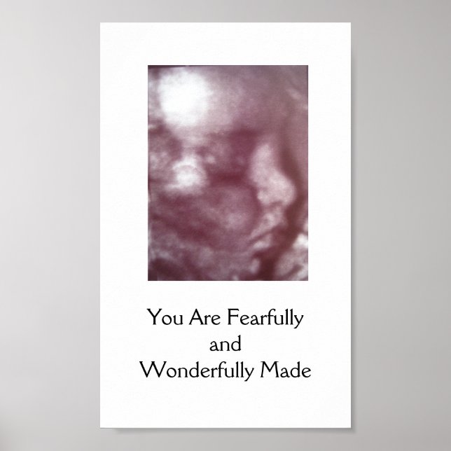 Fearfully and Wonderfully Made / Poster (Front)