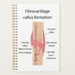 Fibrocartilage Callus formation Planner