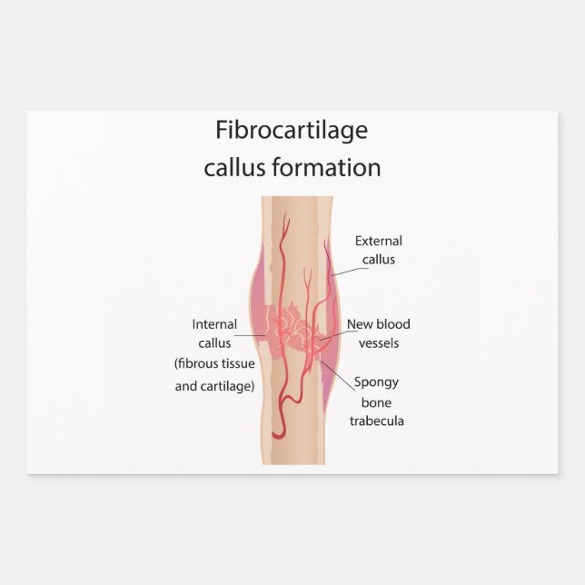 Fibrocartilage Callus formation Wrapping Paper Sheet (Front)