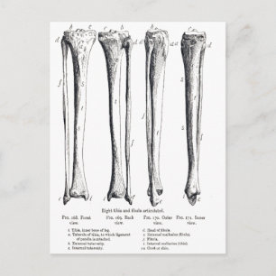 Fibula & Tibia Postcard