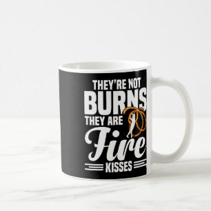 Fire Artist Poi Fire Spinning Fire Dancing Fire Sp Coffee Mug