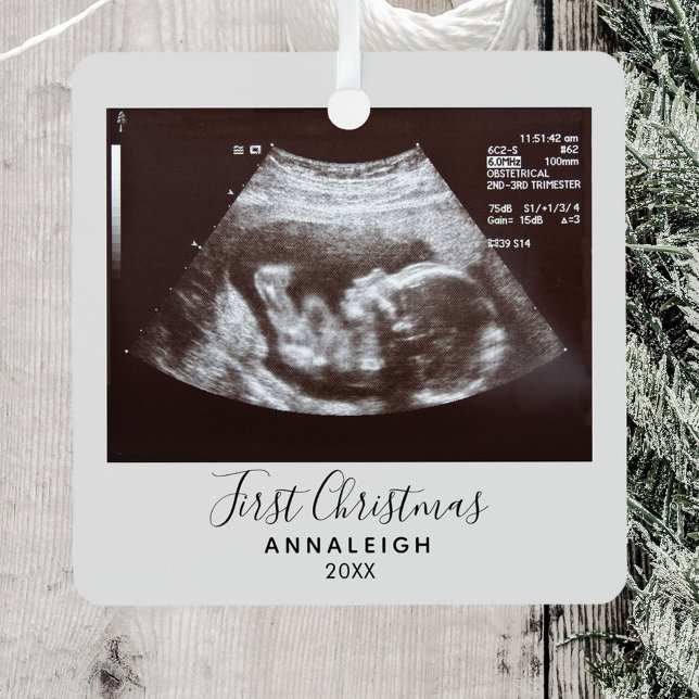 First Christmas Pregnancy Ultrasound Announcement Metal Tree Decoration (First Christmas Sonogram Metal Ornament)