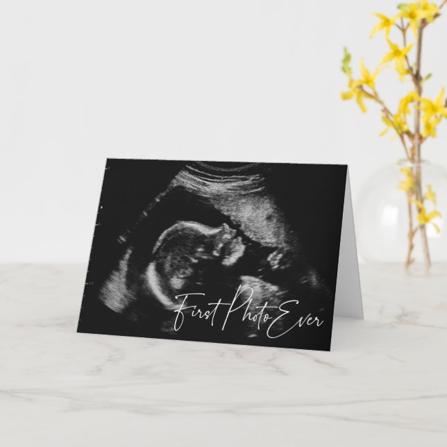 First Photo Ever Ultrasound Baby Shower Card (Yellow Flower)