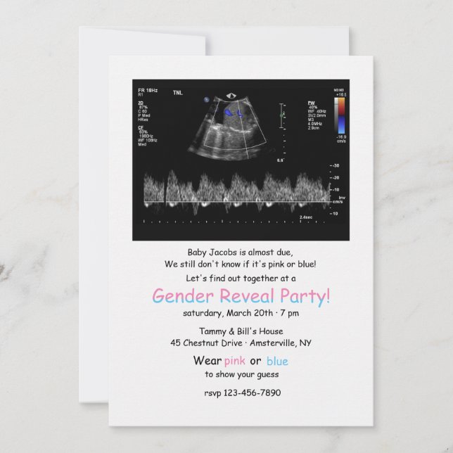 Foetal Doppler Image Gender Reveal Party Invitatio Invitation (Front)