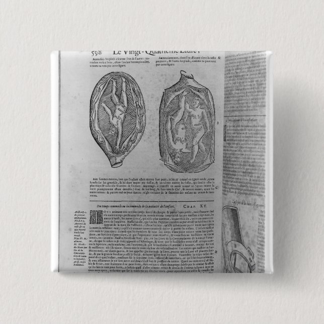 Foetus, illustration from 'Oeuvres' 15 Cm Square Badge (Front)