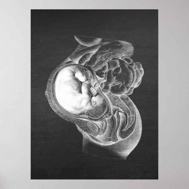 Foetus Womb Anatomy Obstetrics Decor no. 2 (Front)