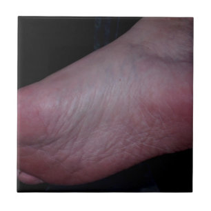 FOOT DOMME TILE