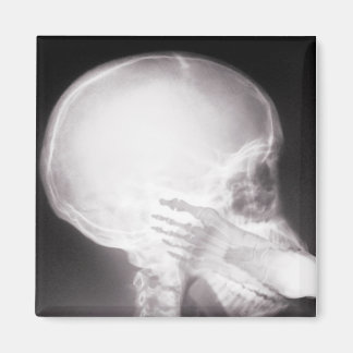 Foot in Mouth X-Ray Magnet