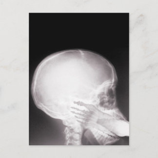 Foot in Mouth X-Ray Postcard