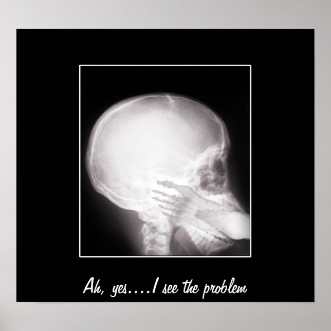 Foot in Mouth X-Ray Poster (Front)