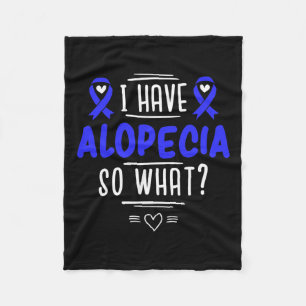 For Spot Baldness Patients Hair Loss  Fleece Blanket