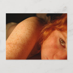 Freckles Postcard