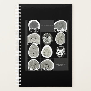 FullCTScan_thisiswhatdepressionlookslike Planner