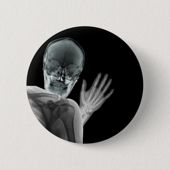 Funny Xray Photobomb 6 Cm Round Badge (Front)