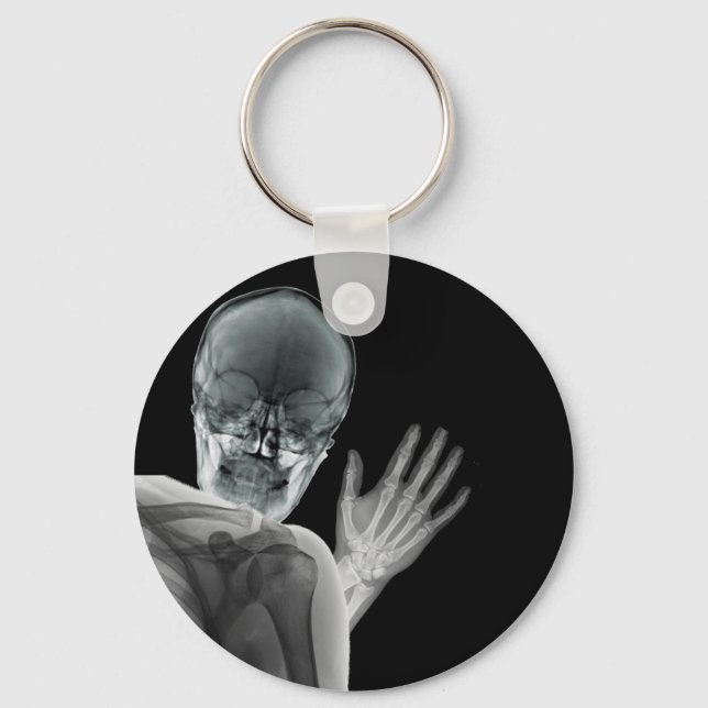 Funny Xray Photobomb Key Ring (Front)