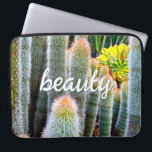 Fuzzy Green Cacti Succulent Photo Beauty Script Laptop Sleeve<br><div class="desc">Cacti thrive in the harshest of desert conditions. Dream of sunny days and the beauty of a summer’s garden whenever you use this stunning photography neoprene laptop sleeve. This laptop sleeve comes in three sizes: 15", 13", and 10”. Makes a great gift for someone special! You can easily personalise this...</div>