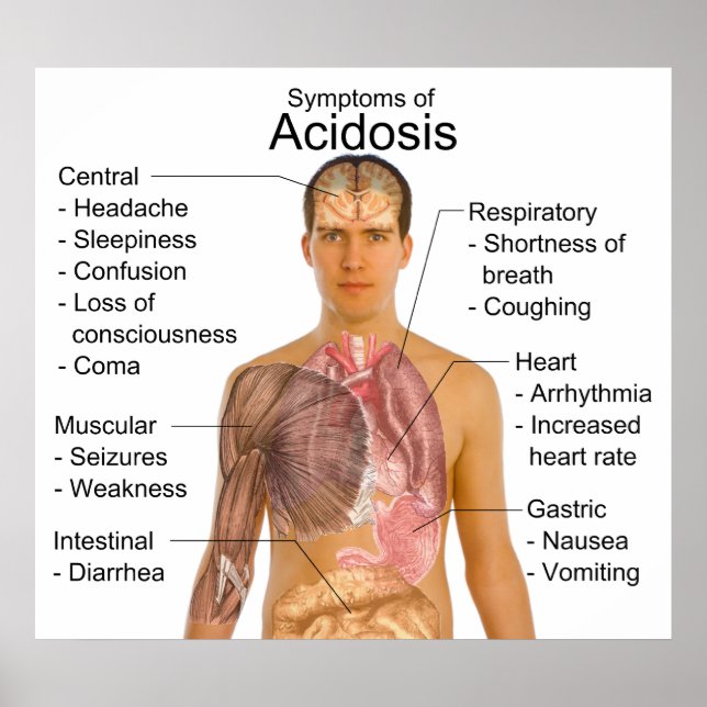 General Symptoms of Blood Acidity Acidosis Poster (Front)
