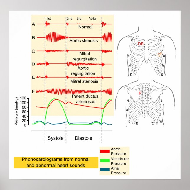 Graphically Recording of Heartbeat Sounds Diagram Poster (Front)
