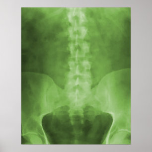 Green Digital X-Ray Art Print