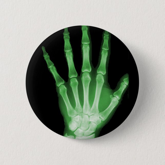 Green X-ray Skeleton Hand 6 Cm Round Badge (Front)