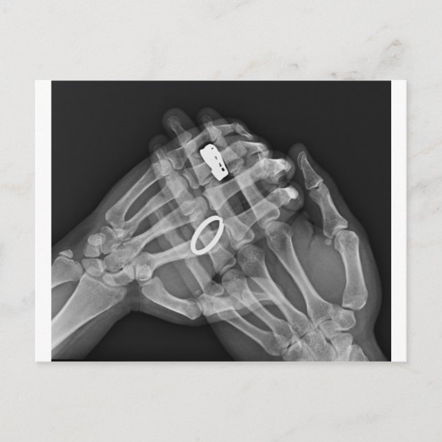 Hand Holding Postcard (Front)