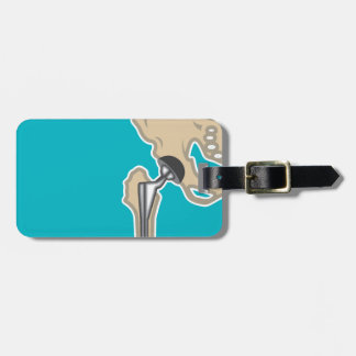 Hip Joint Replacement Luggage Tag