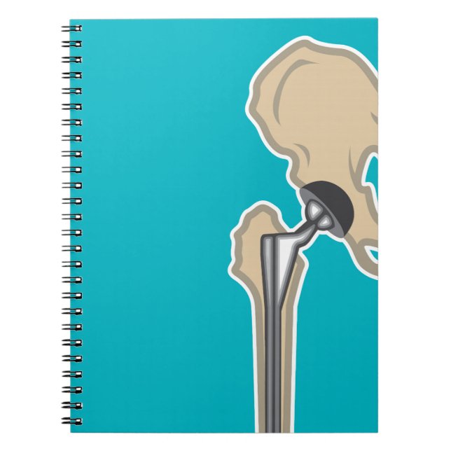 Hip Joint Replacement Spiral Notebook (Front)