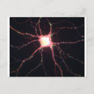 Hippocampal neurons 2 postcard