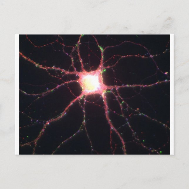 Hippocampal neurons 2 postcard (Front)