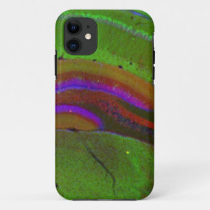 Hippocampal neurons Case-Mate iPhone case