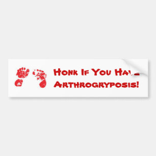 Honk If You HaveArthrogryposis! Bumper Sticker
