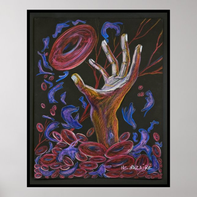 Hope - Sickle Cell Art Print (Front)