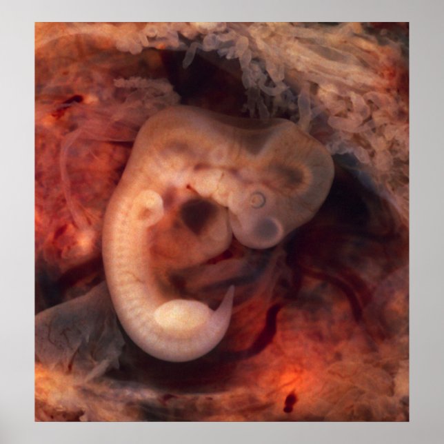 Human Embryo 7th Week of Pregnancy 5th Peek P.O. Poster (Front)
