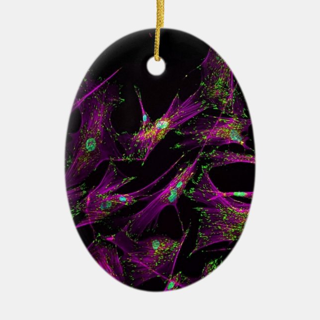 Human lung fibroblasts ceramic tree decoration (Front)