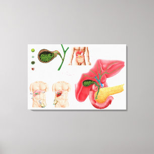 Illustration Depicting Cholecystectomy Canvas Print