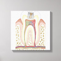 Illustration of Tooth Decay