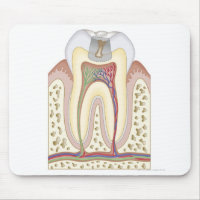 Illustration of Tooth Decay