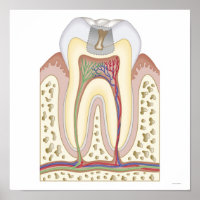 Illustration of Tooth Decay