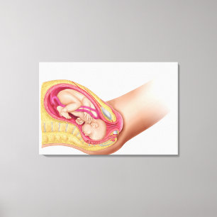 Illustration Showing Delivery Of Foetus 2 Canvas Print