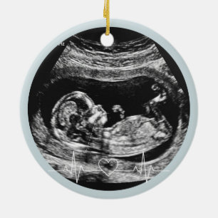 Its a Boy Ultrasound Pregnancy Announcement Baby Ceramic Tree Decoration