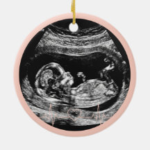 Its a Girl Ultrasound Pregnancy Announcement Baby