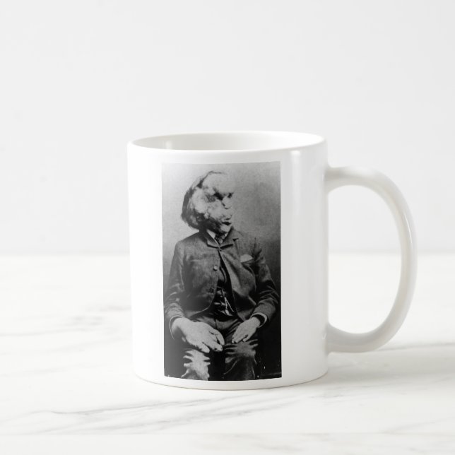 Joseph "John" Merrick The Elephant Man from 1889 Coffee Mug (Right)