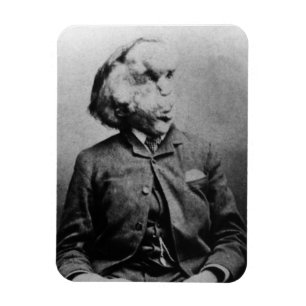 Joseph "John" Merrick The Elephant Man from 1889 Magnet