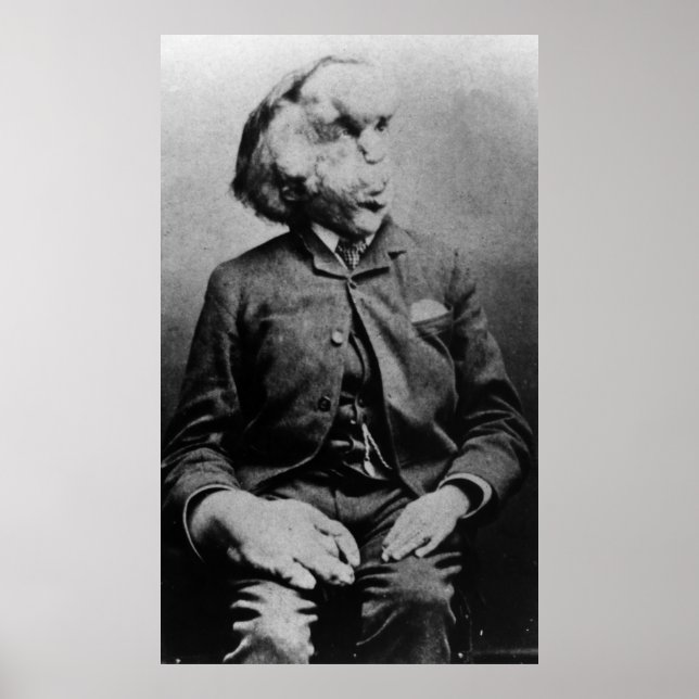 Joseph "John" Merrick The Elephant Man from 1889 Poster (Front)
