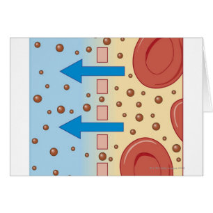 Kidney Dialysis