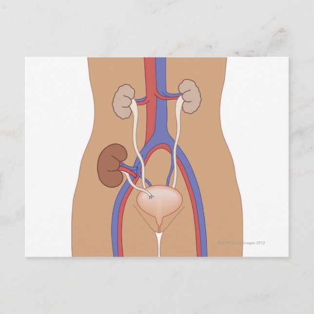 Kidney Transplant Postcard (Front)