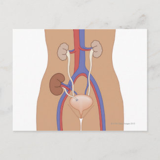 Kidney Transplant Postcard