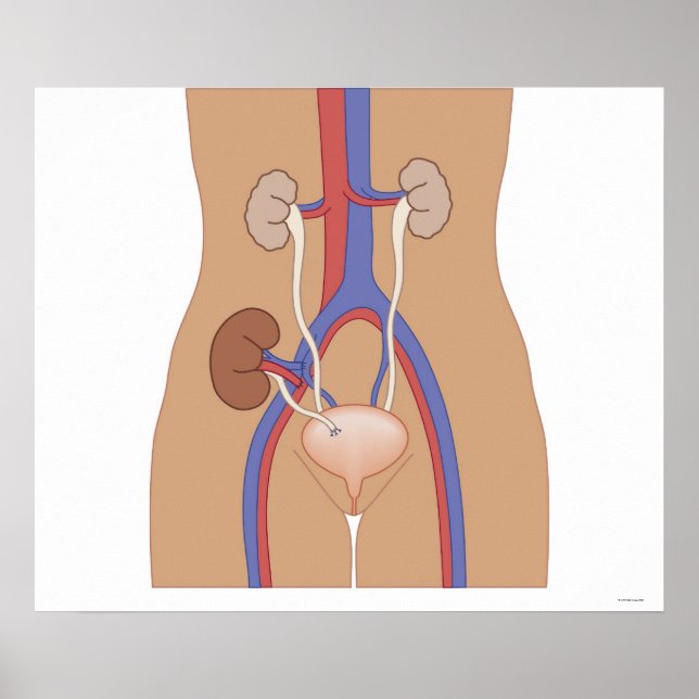 Kidney Transplant Poster (Front)