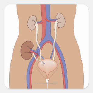 Kidney Transplant Square Sticker