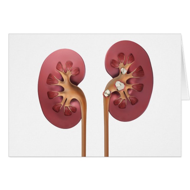 kidneys (Front Horizontal)